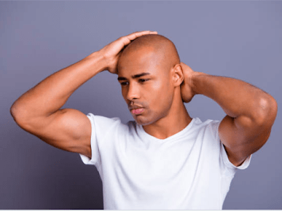 Read more about the article Top 3 Ways to Restore Your Hairline