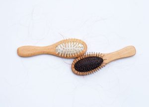 Read more about the article 4 Ways to Stop Ongoing Hair Loss During the Holidays