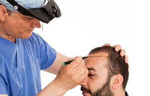 Read more about the article Choosing the Best Hair Transplant in Scottsdale, Arizona