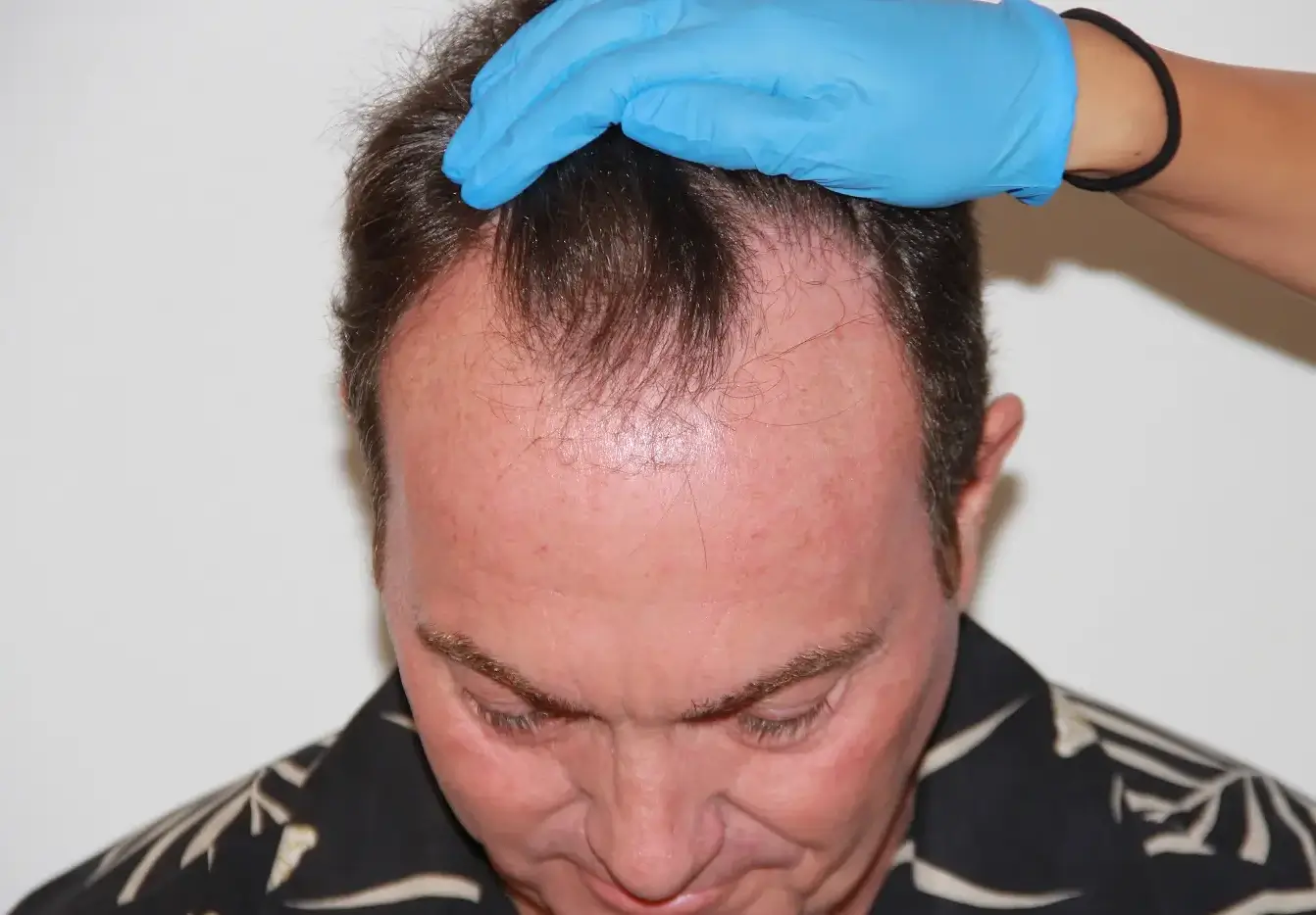 ken before v1 ken before v1