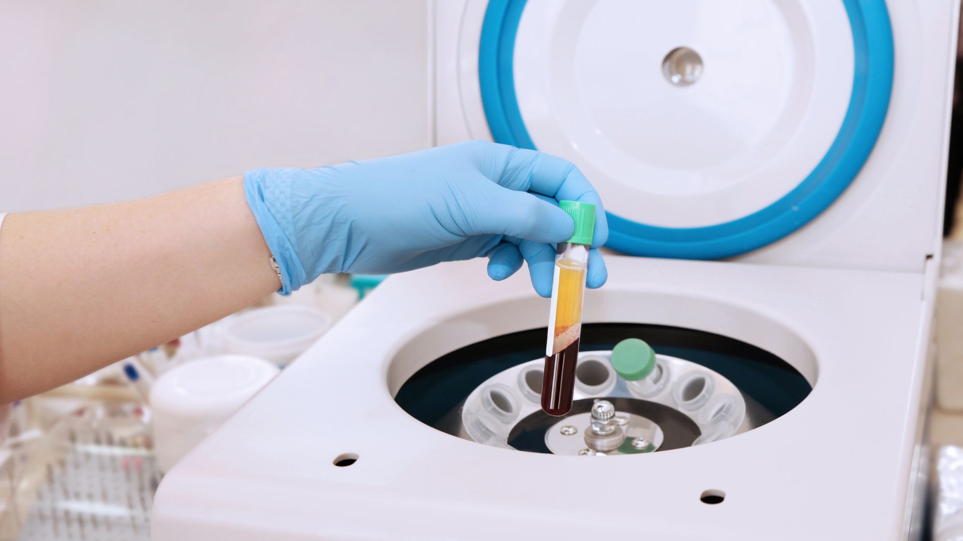 prp services at physicians hair institute