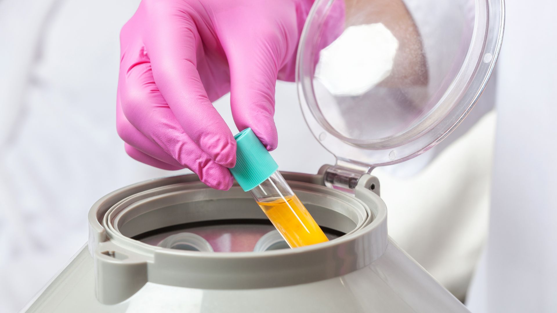 prp vs hair transplant featured image