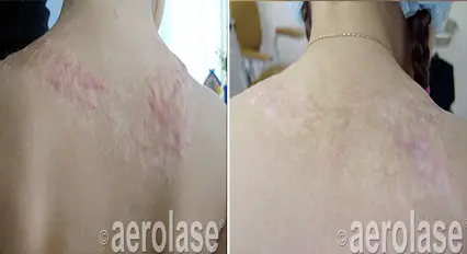 scars7 pair.webp