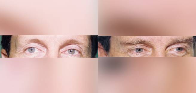 2eye.jpg